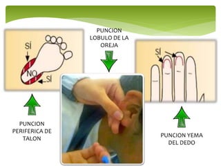 PUNCION
PERIFERICA DE
TALON
PUNCION
LOBULO DE LA
OREJA
PUNCION YEMA
DEL DEDO
 