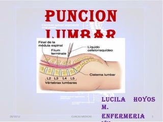 PUNCION
           LUMBAR


                               LUCILA HOYOS
                               M.
28/10/12     CLINCAS MEDICAS   ENFERMERIA 1
 