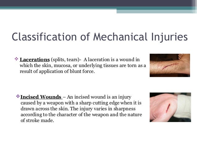Punctured wounds contusion wound diagram 