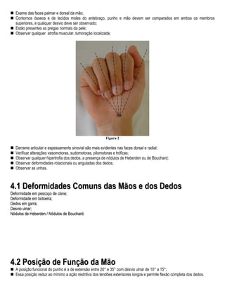 Exame das faces palmar e dorsal da mão;
  Contornos ósseos e de tecidos moles do antebraço, punho e mão devem ser comparados em ambos os membros
  superiores, e qualquer desvio deve ser observado;
  Estão presentes as pregas normais da pele;
  Observar qualquer atrofia muscular, tumoração localizada;




                                                        Figura 2

  Derrame articular e espessamento sinovial são mais evidentes nas faces dorsal e radial;
  Verificar alterações vasomotoras, sudomotoras, pilomotoras e tróficas;
  Observar qualquer hipertrofia dos dedos, a presença de nódulos de Heberden ou de Bouchard;
  Observar deformidades rotacionais ou anguladas dos dedos;
  Observar as unhas.



4.1 Deformidades Comuns das Mãos e dos Dedos
Deformidade em pescoço de cisne;
Deformidade em botoeira;
Dedos em garra;
Desvio ulnar;
Nódulos de Heberden / Nódulos de Bouchard.




4.2 Posição de Função da Mão
  A posição funcional do punho é a de extensão entre 20° e 35° com desvio ulnar de 10° a 15°;
  Essa posição reduz ao mínimo a ação restritiva dos tendões extensores longos e permite flexão completa dos dedos.
 