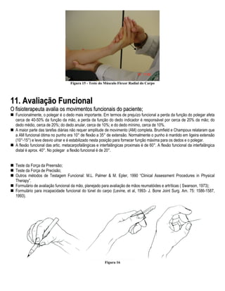 Figura 15 - Teste do Músculo Flexor Radial do Carpo




11. Avaliação Funcional
O fisioterapeuta avalia os movimentos funcionais do paciente;
  Funcionalmente, o polegar é o dedo mais importante. Em termos de prejuízo funcional a perda da função do polegar afeta
  cerca de 40-50% da função da mão, a perda da função do dedo indicador é responsável por cerca de 20% da mão; do
  dedo médio, cerca de 20%; do dedo anular, cerca de 10%; e do dedo mínimo, cerca de 10%.
  A maior parte das tarefas diárias não requer amplitude de movimento (AM) completa. Brumfield e Champoux relataram que
  a AM funcional ótima no punho era 10° de flexão a 35° de extensão. Normalmente o punho é mantido em ligeira extensão
  (10°-15°) e leve desvio ulnar e é estabilizado nesta posição para fornecer função máxima para os dedos e o polegar.
  A flexão funcional das artic. metacarpofalângicas e interfalângicas proximais é de 60°. A flexão funcional da interfalângica
  distal é aprox. 40°. No polegar a flexão funcional é de 20°.


  Teste da Força da Preensão;
  Teste da Força de Precisão;
  Outros métodos de Testagem Funcional: M.L. Palmer & M. Epler, 1990 “Clinical Assessment Procedures in Physical
  Therapy”.
  Formulário de avaliação funcional da mão, planejado para avaliação de mãos reumatóides e artríticas ( Swanson, 1973);
  Formulário para incapacidade funcional do túnel do carpo (Levine, et al, 1993- J. Bone Joint Surg. Am. 75: 1586-1587,
  1993).




                                                         Figura 16
 