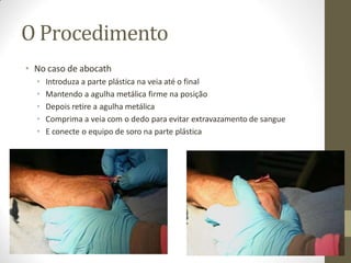 O Procedimento
• No caso de abocath
• Introduza a parte plástica na veia até o final
• Mantendo a agulha metálica firme na posição
• Depois retire a agulha metálica
• Comprima a veia com o dedo para evitar extravazamento de sangue
• E conecte o equipo de soro na parte plástica
 