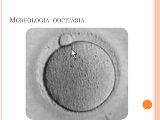 MORFOLOGIA OOCITÁRIA
 