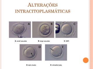 ALTERAÇÕES
INTRACITOPLASMÁTICAS
 