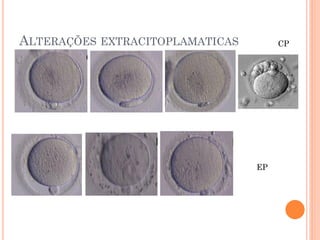 ALTERAÇÕES EXTRACITOPLAMATICAS        CP




                                 EP
 