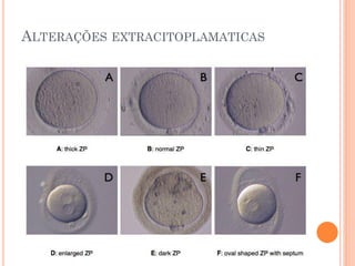 ALTERAÇÕES EXTRACITOPLAMATICAS
 