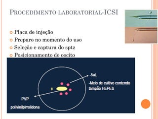 PROCEDIMENTO LABORATORIAL-ICSI

 Placa de injeção
 Preparo no momento do uso

 Seleção e captura do sptz

 Posicionamento do oocito
 