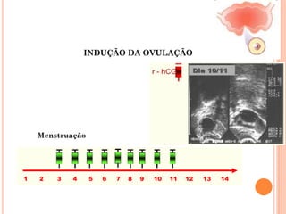 INDUÇÃO DA OVULAÇÃO




Menstruação
 