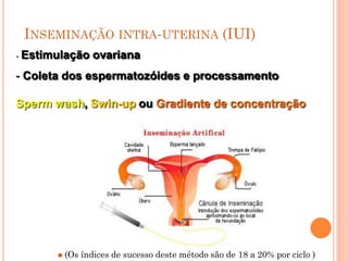 INSEMINAÇÃO INTRA-UTERINA (IUI)
- Estimulação    ovariana
- Coleta dos espermatozóides e processamento

Sperm wash, Swin-up ou Gradiente de concentração




          (Os índices de sucesso deste método são de 18 a 20% por ciclo )
 