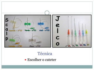 Técnica
 Escolher o cateter

 