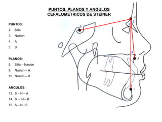 PUNTOS, PLANOS Y ANGULOS CEFALOMETRICOS DE STEINER N A S B 1 2 3 PUNTOS: Silla Nasion A B PLANOS: Silla – Nasion Nasion – A Nasion – B ANGULOS: S – N – A S  -  N – B A – N - B 
