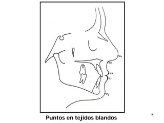 1414
Puntos en tejidos blandosPuntos en tejidos blandos
 