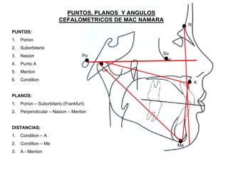 PUNTOS, PLANOS Y ANGULOS
CEFALOMETRICOS DE MAC NAMARA
N
Po
Co
So
A
Me
PUNTOS:
1. Porion
2. Suborbitario
3. Nasion
4. Punto A
5. Menton
6. Condilion
PLANOS:
1. Porion – Suborbitario (Frankfurt)
2. Perpendicular – Nasion – Menton
DISTANCIAS:
1. Condilion – A
2. Condilion – Me
3. A - Menton
 