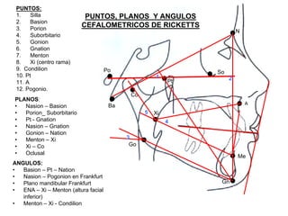 PUNTOS, PLANOS Y ANGULOS
CEFALOMETRICOS DE RICKETTS
N
Po
Ba
Co
Pt
So
A
Me
Gn
Go
Xi
1 2
3
4
5
PUNTOS:
1. Silla
2. Basion
3. Porion
4. Suborbitario
5. Gonion
6. Gnation
7. Menton
8. Xi (centro rama)
9. Condilion
10. Pt
11. A
12. Pogonio.
PLANOS:
• Nasion – Basion
• Porion_ Suborbitario
• Pt - Gnation
• Nasion – Gnation
• Gonion – Nation
• Menton – Xi
• Xi – Co
• Oclusal
ANGULOS:
• Basion – Pt – Nation
• Nasion – Pogonion en Frankfurt
• Plano mandibular Frankfurt
• ENA – Xi – Menton (altura facial
inferior)
• Menton – Xi - Condilion
 