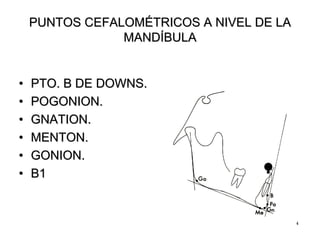 44
PUNTOS CEFALOMPUNTOS CEFALOMÉÉTRICOS A NIVEL DE LATRICOS A NIVEL DE LA
MANDMANDÍÍBULABULA
•• PTO. B DE DOWNS.PTO. B DE DOWNS.
•• POGONION.POGONION.
•• GNATION.GNATION.
•• MENTON.MENTON.
•• GONION.GONION.
•• B1B1
 