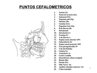 55
1.1. NasionNasion (N)(N)
2.2. Punto de la nariz (En)Punto de la nariz (En)
3.3. SubnasalSubnasal (SN)(SN)
4.4. PogonionPogonion piel (piel (PgPg))
5.5. MentMentóón (Men (Me
6.6. GnationGnation ((GnGn))
7.7. PogonionPogonion óóseo (seo (PgPg))
8.8. B deB de DownsDowns (B)(B)
9.9. InfradentalInfradental
10.10. InterincisivoInterincisivo II
11.11. ProstionProstion PrPr
12.12. A deA de DownsDowns AA
13.13. Espina nasal anterior SPNEspina nasal anterior SPN
14.14. SuborbitarioSuborbitario OrOr
15.15. Espina nasal posterior SPPEspina nasal posterior SPP
16.16. FosaFosa pterigomaxilarpterigomaxilar PtPt
17.17. Velo del PaladarVelo del Paladar
18.18. GonionGonion GoGo
19.19. ArticularisArticularis ArAr
20.20. CentroCentro condilocondilo..
21.21. SincondrosisSincondrosis esfeno occipitalesfeno occipital
22.22. BasionBasion ((BaBa))
23.23. PoriPorióónn ((PoPo))
24.24. Silla Turca )S)Silla Turca )S)
25.25. ApApóófisisfisis clinoidesclinoides anterior. (T)anterior. (T)
26.26. Criba etmoidalCriba etmoidal
PUNTOS CEFALOMETRICOSPUNTOS CEFALOMETRICOS
 