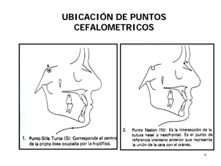 66
UBICACIUBICACIÓÓN DE PUNTOSN DE PUNTOS
CEFALOMETRICOSCEFALOMETRICOS
 