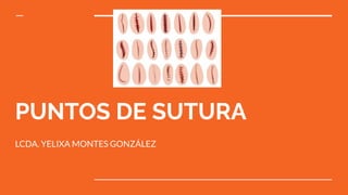 PUNTOS DE SUTURA
LCDA. YELIXA MONTES GONZÁLEZ
 