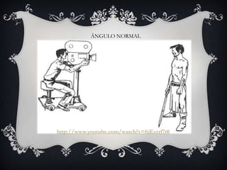 ÁNGULO NORMAL




http://www.youtube.com/watch?v=ftjEcrrf7r0
 