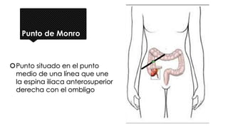 Punto de Monro
Punto situado en el punto
medio de una línea que une
la espina iliaca anterosuperior
derecha con el ombligo
 