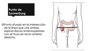 Punto de
Sonnerburg
Punto situado en la intersección
de la línea que une ambas
espinas iliacas anterosuperiores
con el musculo recto anterior
derecho
 