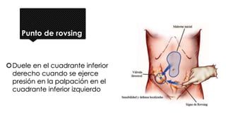 Punto de rovsing
Duele en el cuadrante inferior
derecho cuando se ejerce
presión en la palpación en el
cuadrante inferior izquierdo
 