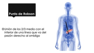 Punto de Robson
Unión de los 2/3 medio con el
inferior de una línea que va del
pezón derecho al ombligo
 