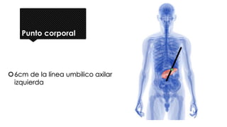 Punto corporal
6cm de la línea umbilico axilar
izquierda
 