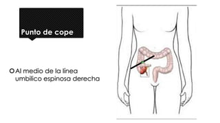 Punto de cope
Al medio de la línea
umbilico espinosa derecha
 