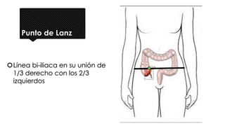 Punto de Lanz
Línea bi-iliaca en su unión de
1/3 derecho con los 2/3
izquierdos
 