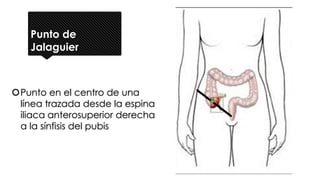 Punto de
Jalaguier
Punto en el centro de una
línea trazada desde la espina
iliaca anterosuperior derecha
a la sínfisis del pubis
 