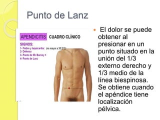 Punto de Lanz 
 El dolor se puede 
obtener al 
presionar en un 
punto situado en la 
unión del 1/3 
externo derecho y 
1/3 medio de la 
línea biespinosa. 
Se obtiene cuando 
el apéndice tiene 
localización 
pélvica. 
 