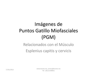 Imágenes de
             Puntos Gatillo Miofasciales
                      (PGM)
              Relacionados con el Músculo
               Esplenius capitis y cervicis


                     www.tianxie.mx, ventas@tianxie.mx
17/01/2012
                            Tel.: (81)11590051
 