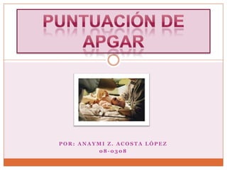 Por: Anaymi Z. Acosta López 08-0308 Puntuación de Apgar 