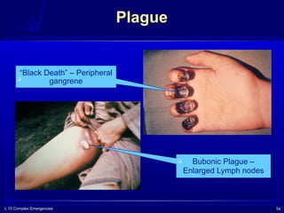 L 10 Complex Emergencies 54
Plague
❑ Bubonic Plague –
Enlarged Lymph nodes
❑
“Black Death” – Peripheral
gangrene
 