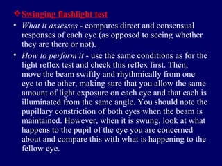 Swinging flashlight test What it assesses  - compares direct and consensual responses of each eye (as opposed to seeing whether they are there or not).  How to perform it  - use the same conditions as for the light reflex test and check this reflex first. Then, move the beam swiftly and rhythmically from one eye to the other, making sure that you allow the same amount of light exposure on each eye and that each is illuminated from the same angle. You should note the pupillary constriction of both eyes when the beam is maintained. However, when it is swung, look at what happens to the pupil of the eye you are concerned about and compare this with what is happening to the fellow eye. 