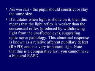 Normal test  - the pupil should constrict or stay the same size.  If it dilates when light is shone on it, then this means that the light reflex is weaker than the consensual reflex (produced by withdrawing light from the unaffected eye), suggesting optic nerve pathology. This abnormal response is known as a relative afferent pupillary defect (RAPD) and is a very important sign. Note that this is a comparative test: you cannot have a bilateral RAPD.  
