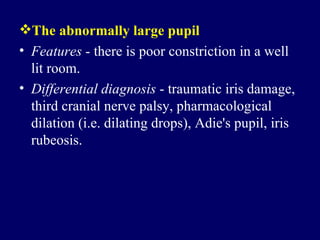 The abnormally large pupil Features  - there is poor constriction in a well lit room.  Differential diagnosis  - traumatic iris damage, third cranial nerve palsy, pharmacological dilation (i.e. dilating drops), Adie's pupil, iris rubeosis.  