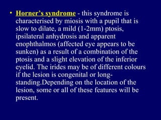 Horner’s syndrome  - this syndrome is characterised by miosis with a pupil that is slow to dilate, a mild (1-2mm) ptosis, ipsilateral anhydrosis and apparent enophthalmos (affected eye appears to be sunken) as a result of a combination of the ptosis and a slight elevation of the inferior eyelid. The irides may be of different colours if the lesion is congenital or long-standing.Depending on the location of the lesion, some or all of these features will be present.  