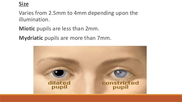 cn iii compression and fixed dilated pupil cn iii compression and fixed dilated pupil