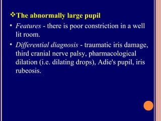 The abnormally large pupil
• Features - there is poor constriction in a well
lit room.
• Differential diagnosis - traumatic iris damage,
third cranial nerve palsy, pharmacological
dilation (i.e. dilating drops), Adie's pupil, iris
rubeosis.
 