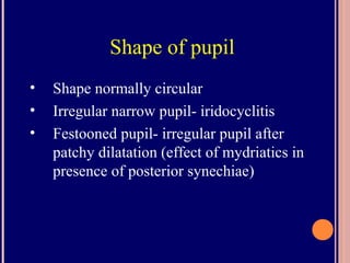 Shape of pupil
• Shape normally circular
• Irregular narrow pupil- iridocyclitis
• Festooned pupil- irregular pupil after
patchy dilatation (effect of mydriatics in
presence of posterior synechiae)
 