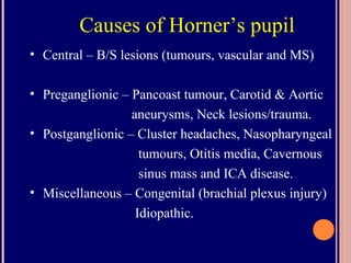 Causes of Horner’s pupil
• Central – B/S lesions (tumours, vascular and MS)
• Preganglionic – Pancoast tumour, Carotid & Aortic
aneurysms, Neck lesions/trauma.
• Postganglionic – Cluster headaches, Nasopharyngeal
tumours, Otitis media, Cavernous
sinus mass and ICA disease.
• Miscellaneous – Congenital (brachial plexus injury)
Idiopathic.
 