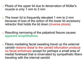  Ptosis of the upper lid due to denervation of Müller's
muscle is only 1 mm to 3 mm
 The lower lid is frequently elevated 1 mm to 2 mm
because of loss of the action of the lower lid accessory
retractor that holds the lid down (inverse ptosis)
 Resulting narrowing of the palpebral fissure causes
apparent enophthalmos
 Fibers mediating facial sweating travel up the external
carotid--lesions distal to the carotid bifurcation produce
no facial anhidrosis except for perhaps a small area of
medial forehead that is innervated by sympathetic fibers
traveling with the internal carotid
 
