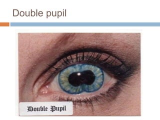 nvr double pupil nvr double pupil