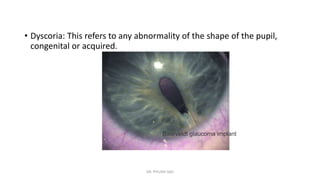 Pupil And its Abnormalities | PPTX