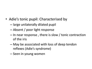 • Adie’s tonic pupil: Characterised by
– large unilaterally dilated pupil
– Absent / poor light response
– In near response , there is slow / tonic contraction
of the iris
– May be associated with loss of deep tendon
reflexes (Adie’s syndrome)
– Seen in young women
 