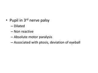 • Pupil in 3rd nerve palsy
– Dilated
– Non reactive
– Absolute motor paralysis
– Associated with ptosis, deviation of eyeball
 