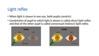 Light Reflex Example various types of abnormal PUPIL reflexes .pptx