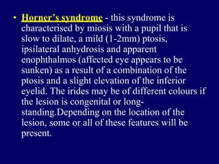 • Horner’s syndrome - this syndrome is
characterised by miosis with a pupil that is
slow to dilate, a mild (1-2mm) ptosis,
ipsilateral anhydrosis and apparent
enophthalmos (affected eye appears to be
sunken) as a result of a combination of the
ptosis and a slight elevation of the inferior
eyelid. The irides may be of different colours if
the lesion is congenital or long-
standing.Depending on the location of the
lesion, some or all of these features will be
present.
 